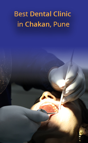 Best Dentist and Dental Clinic in Chakan, Pune